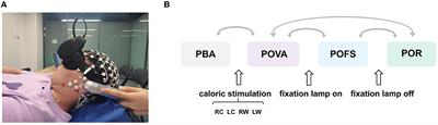 Assessing vestibular function using electroencephalogram rhythms evoked during the caloric test